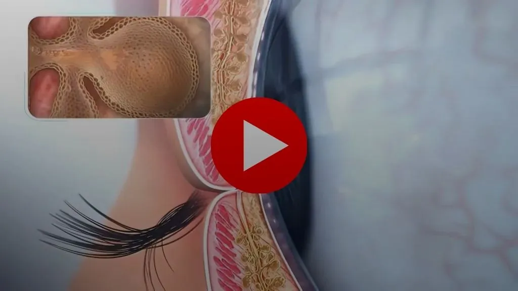 Blue light eye damage